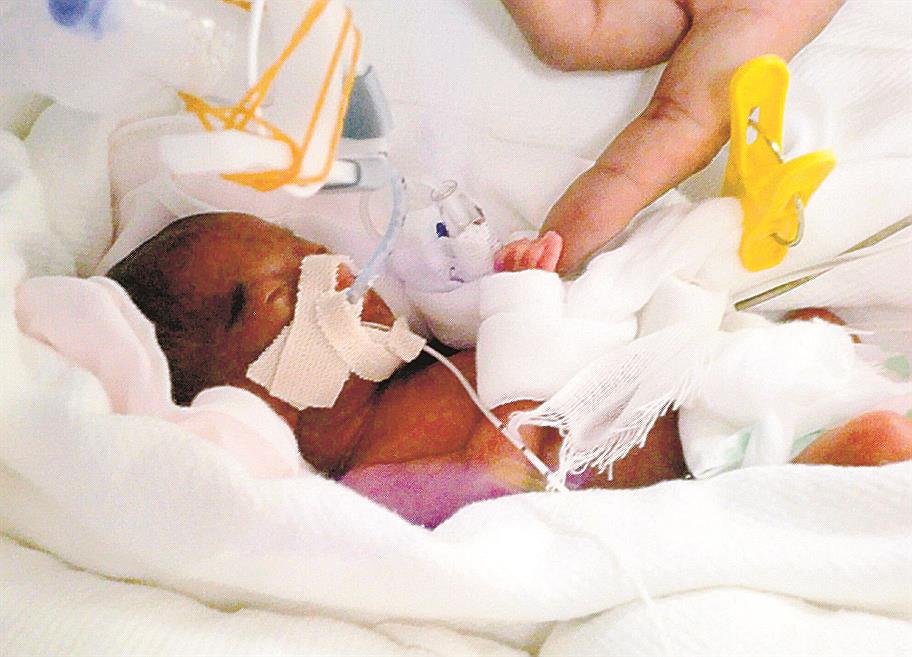 ３１６グラムで生まれた女児 小学生に 離島医療 多くの人に支えられ 隠岐の島 高井結葵さん 山陰中央新報デジタル